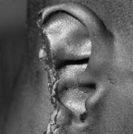 oreja de holyfield